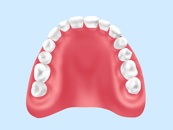 レジン床義歯【保険診療】