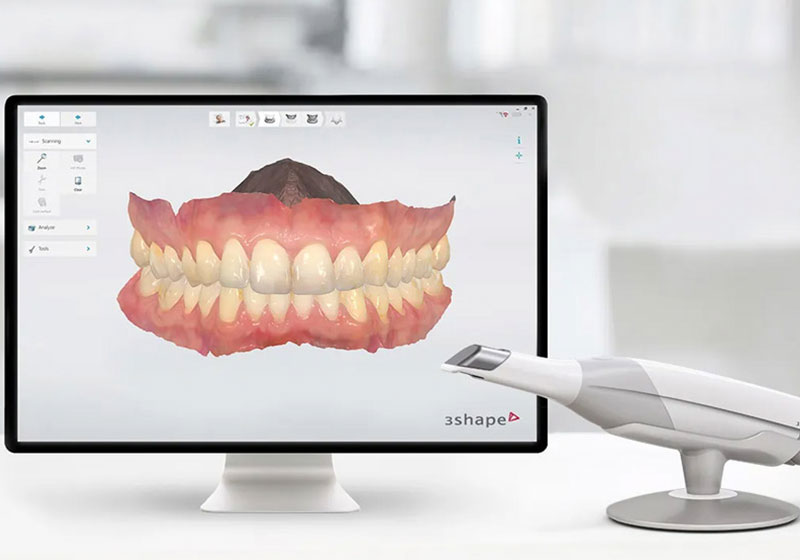 口腔内スキャナー：トリオス